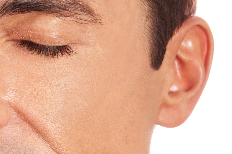 Otoplastia cirgía de oreja gudalajara